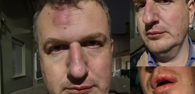 Ξυλοδαρμός του εκδότη της ΜΑΓΝΗΣΙΑΣ